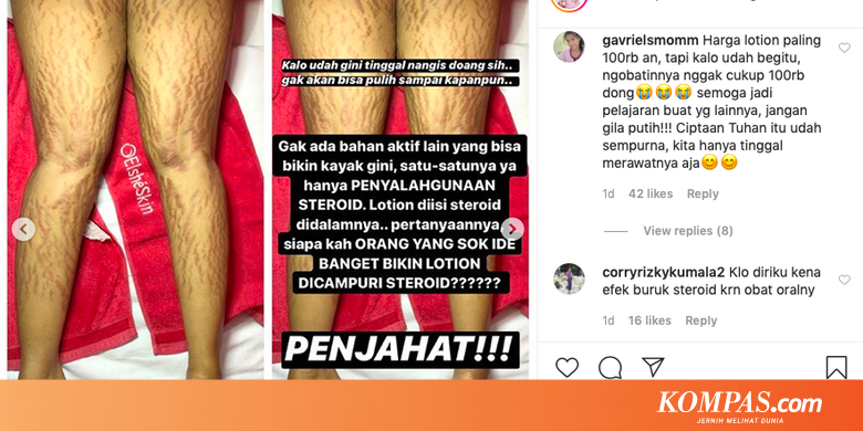 Efek Buruk Krim Kulit Abal-abal Tak Muncul Seketika