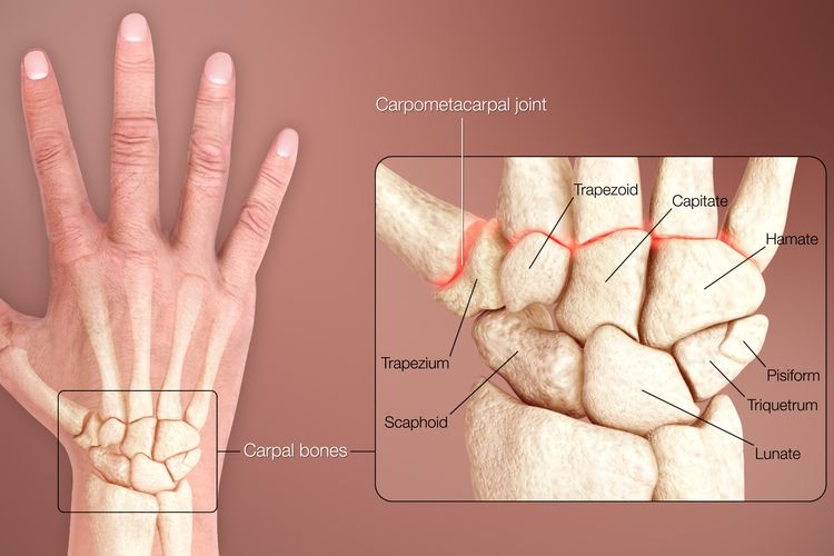Tulang karpal atau tulang pergelangan tangan yang termasuk ke dalam tulang pendek.