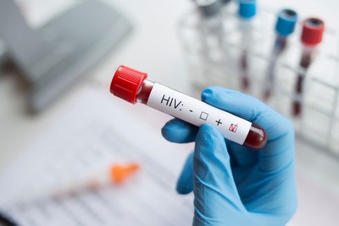8 Tahun Didiagnosis dengan HIV, Seorang Wanita Mampu “Sembuh” dari Virus Secara Alami