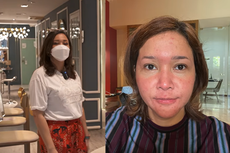 Ada Penyakit Kulit Rosacea, Jadi Alasan Maia Estianty Punya Klinik Sendiri