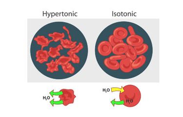 Perbedaan sel darah merah dalam larutan hipertonik (mengalami krenasi) dan dalam larutan isotonik (keadaan normal).