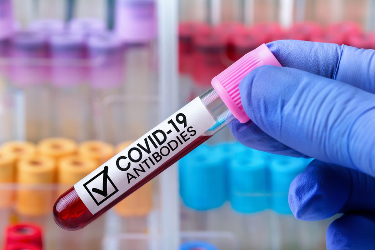 Ilustrasi tes antibodi terhadap SARS-CoV-2. Ilmuwan menemukan cara deteksi antibodi Covid-19 yang lebih cepat dan akurat hanya dengan sampel air liur.