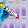 Cytomegalovirus 
