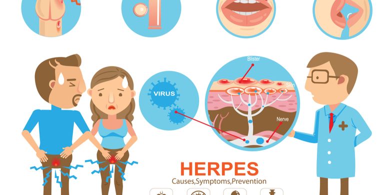 Penyebab penyakit herpes simplex genitalis
