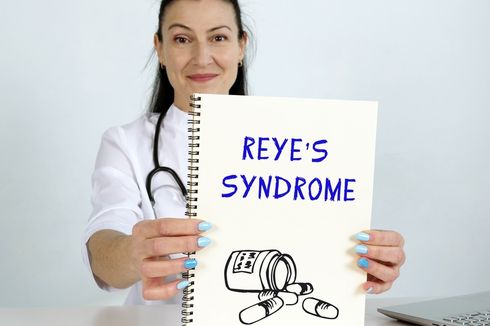 Sindrom Reye