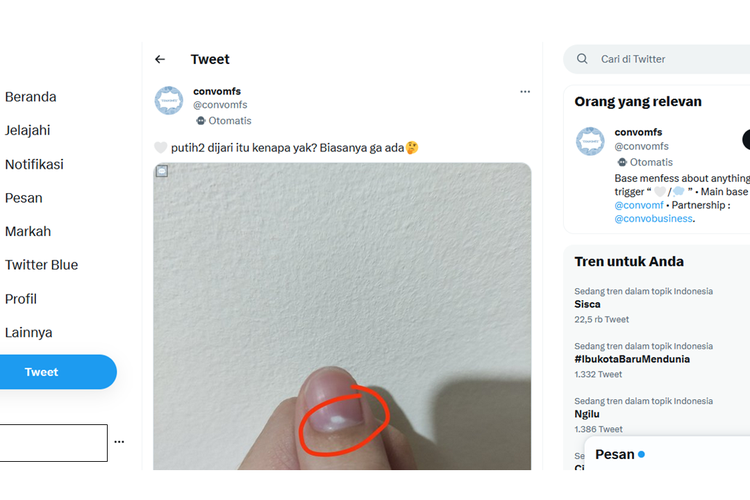 Tangkapan layar unggahan menyebut terdapat bercak putih di kuku tangan
