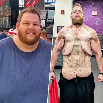 Cole Prochaska sebelum dan sesudah perjalanan penurunan berat badannya. 