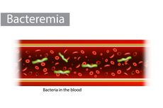 Bakteremia