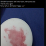 Viral, Unggahan Telur Asin Berwarna Merah, Apakah Bisa Dikonsumsi?