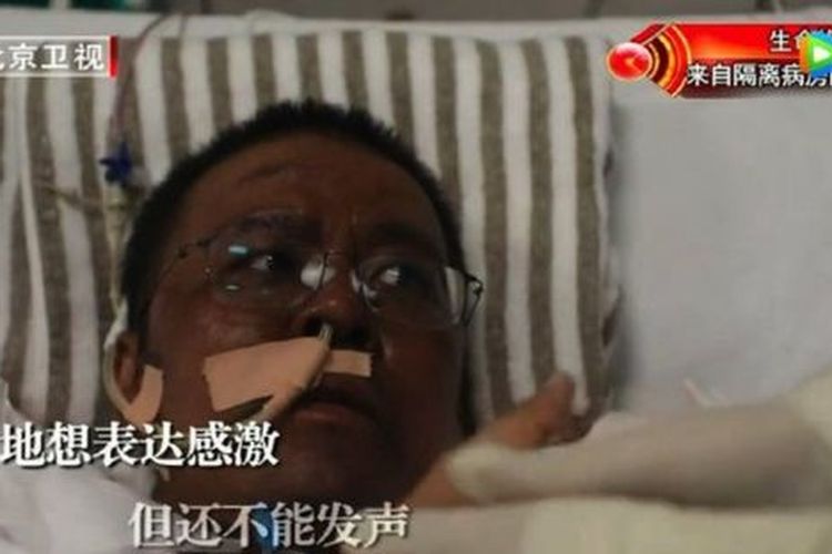 Dr Hu Weifeng, dokter di Wuhan yang menjadi viral pada April setelah kulitnya menghitam dikarenakan pengobatan virus corona. Dia meninggal pada Selasa (2/6/2020) setelah lima bulan berjuang.