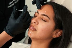 Waspada Overfilled Syndrome, Bahaya Filler Berlebihan di Wajah