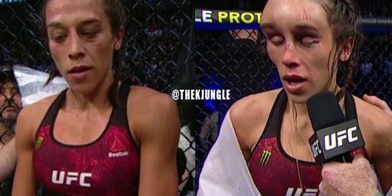 Joanna Jedrzejczyk Buka Suara Soal Cedera Kepala Horor Lawan Zhang Weili Halaman All Kompas Com