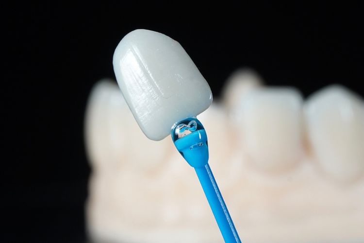 Industri Dental Estetika Tumbuh, Pelaku Usaha Pacu Investasi dan Ekspansi