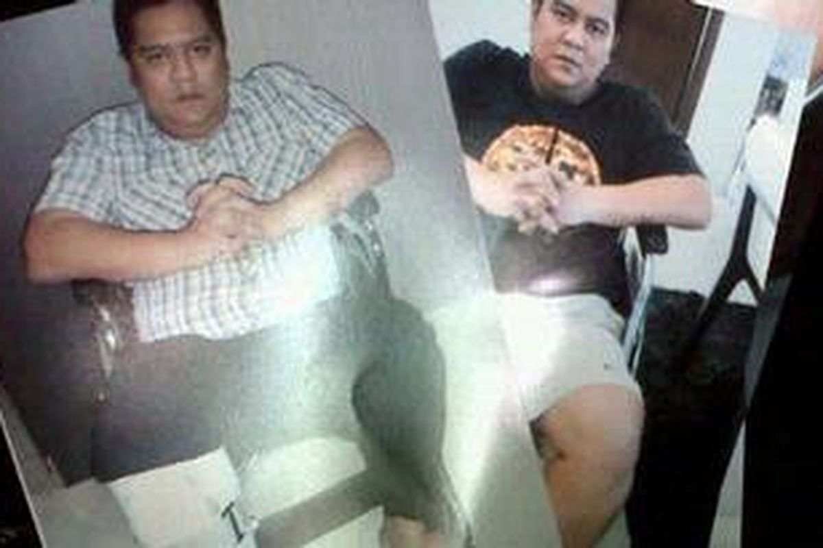 Foto-foto kondisi tersangka kasus dugaan korupsi pengadaan Al Quran dan laboratorium Kementerian Agama, Dendy Prasetya, yang ditunjukkan pengacaranya, Erman Umar, di gedung KPK, Kuningan, Jakarta, Kamis (23/8/2012). Dendy dikatakan mengalami remuk tulang akibat kecelakaan.