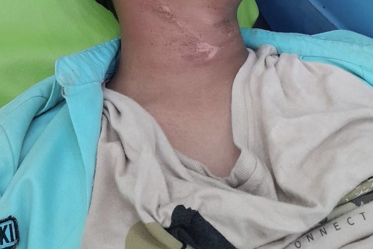 Kabel Menjuntai di Bangkalan Jerat Leher Siswa SMA, Korban: Mendadak Jatuh dan Terasa Kesetrum