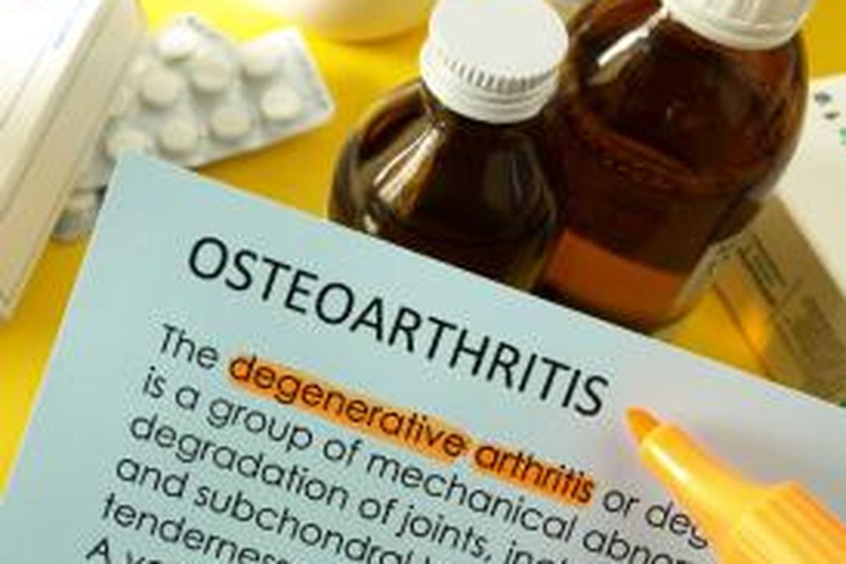 Ilustrasi osteoartritis