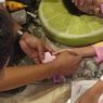 Jari Tangannya Terjepit di Lubang Tutup Botol, Anak Ini Pilih ke Damkar daripada Ditolong Dokter