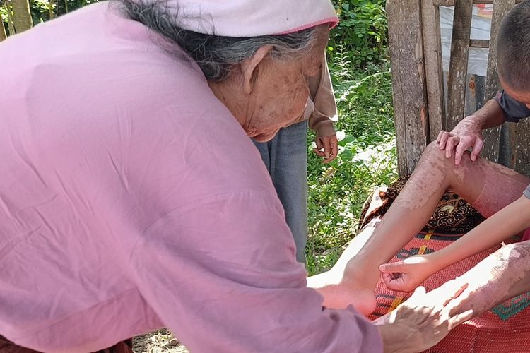 Rawat Anak Diduga Dibakar Teman Santrinya di Lombok, Keluarga Rela Jual Sapi dan Berutang