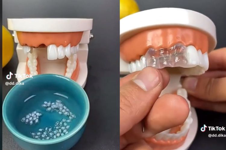 Tangkapan layar video soal tambal gigi atau pasang gigi dengan gel temporary teeth
