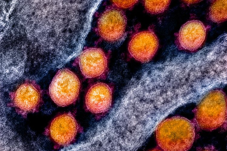 Partikel virus corona Sars-CoV-2 di sel manusia.