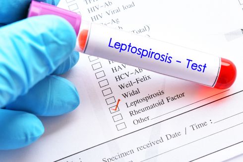 Ada 87 Pasien Leptospirosis di Jateng, 7 di Antaranya Meninggal