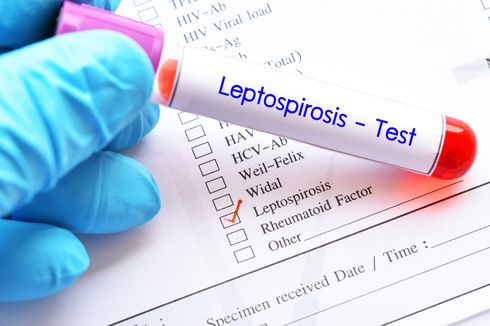 Leptospirosis