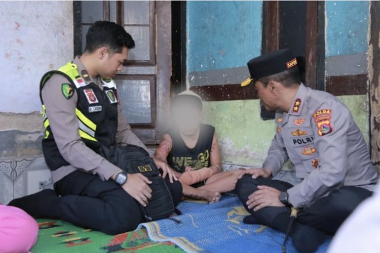 LPA Mataram Bantah Cegat Korban Pembakaran Ponpes ke Podcast: Anak Masih Dirawat