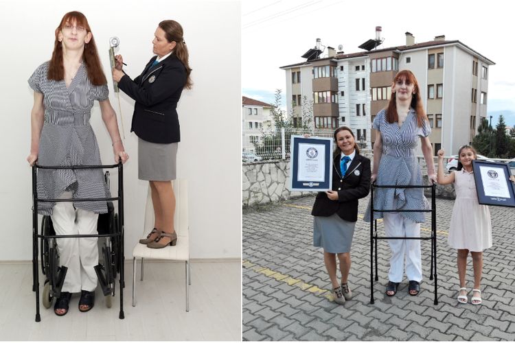 Rumeysa Gelgi, yang tingginya 7 kaki 0,7 inci (215,16 cm), secara resmi dinobatkan sebagai wanita tertinggi yang hidup oleh Guinness World Records, pada Rabu (13/10/2021).

