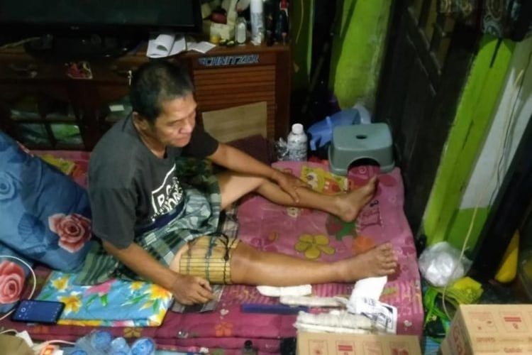 Rudi (58) warga Banjarmasin yang menjadi korban tabrak oknum polisi yang bertugas di Polda Kalsel hanya bisa terbaring di rumahnya karena mengalami patah kaki. 