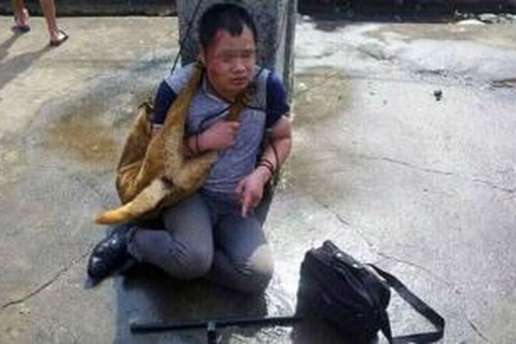 Inilah salah seorang tersangka pencuri anjing yang tertangkap warga sebuah desa di provinsi Hunan, China. Warga desa yang marah memukuli tersangka selama sembilan jam sebelum polisi tiba di lokasi.