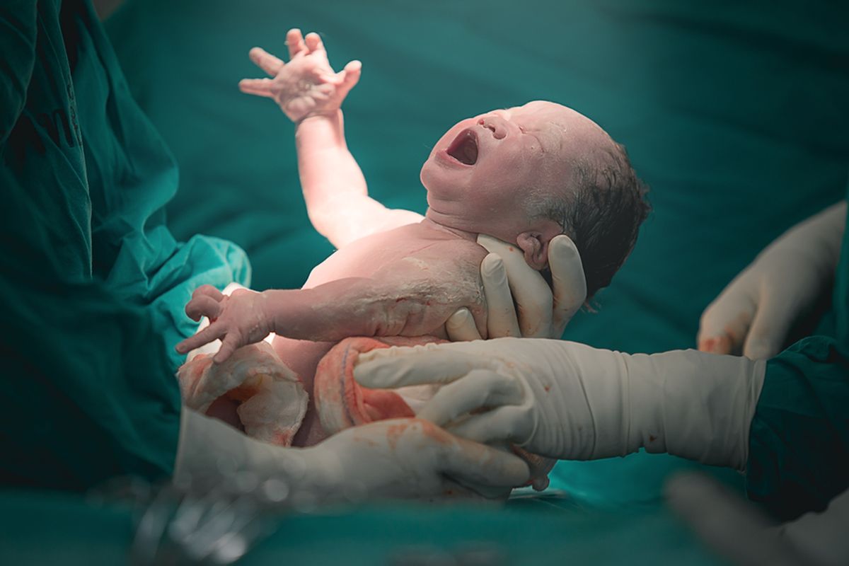 Ilustrasi bayi pada proses persalinan. Berikut pengurusan akta kelahiran baru (bayi baru lahir) di Disdukcapil Kota Madiun baik langsung di kantor maupun secara online.