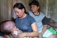 Setelah Hampir 2 Tahun, Bayi Penderita Hidrosefalus Akhirnya Bisa Berobat di Rumah Sakit