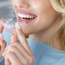 Tren Merapikan Gigi dengan Clear Aligner, Lebih Efektif dari Behel?