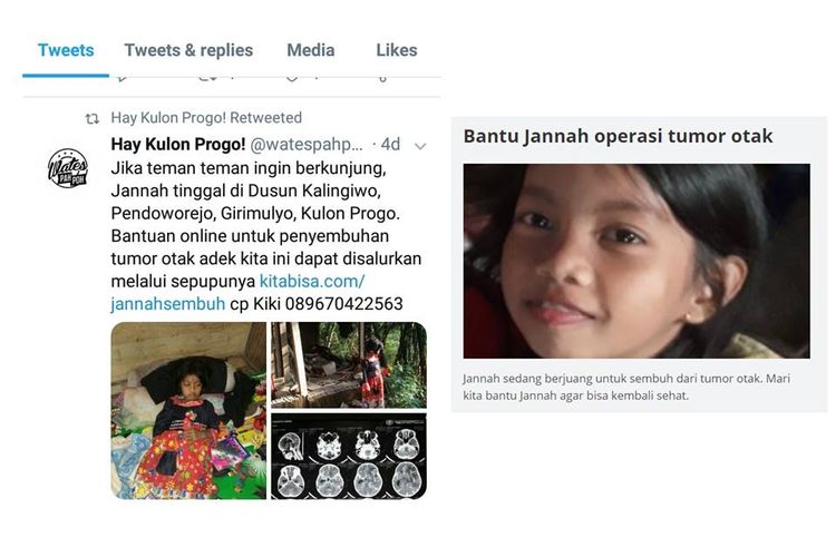 Jannah, gadis usia 8 tahun yang menderita tumor otak. Ia harus segera dioperasi, tetapi masih menghadapi keterbatasan biaya.