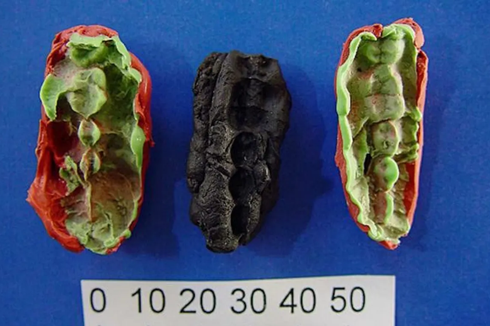 Permen Karet Berusia 10.000 Tahun Ungkap Pola Makan Remaja Zaman Batu