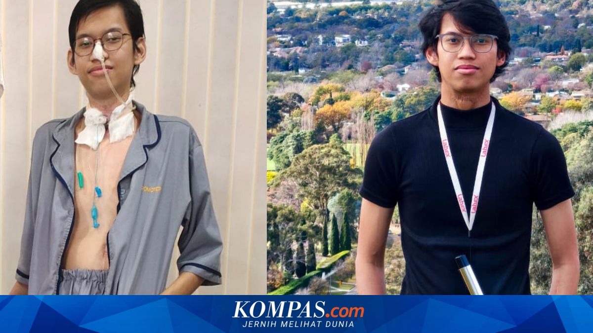 Kisah Sultan Rifat, Terjerat Kabel Fiber hingga Pita Suara Hilang, Kini Kuliah S2 di Australia