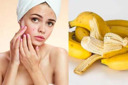 3 Resep Masker Wajah dari Kulit Pisang untuk Atasi Jerawat