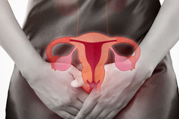 Ilustrasi kanker serviks, kebiasaan penyebab kanker serviks pada wanita yang sebaiknya dihindari. 