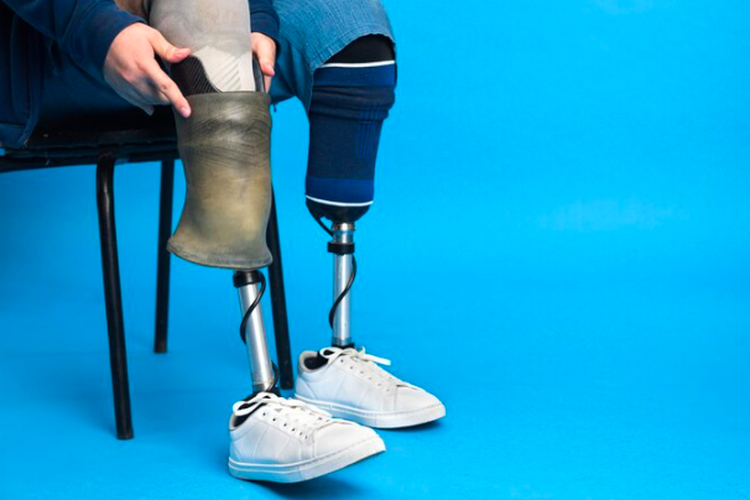 Cara klaim kaki palsu BPJS Kesehatan. Ketentuan klaim kaki palsu BPJS Kesehatan. Cara klaim protesa alat gerak BPJS Kesehatan.