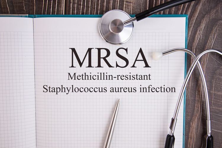 Ilustrasi MRSA Methicillin-resistant Staphylococcus Aureus Infection