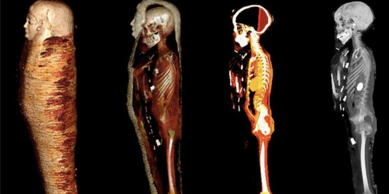 Sebuah tim peneliti dari Mesir menggunakan pemindaian topografi untuk mempelajari mumi berusia 2.300 tahun yang disimpan di gudang selama lebih dari satu abad.