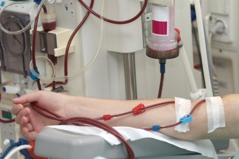 Penderita Gagal Ginjal Ini Gratis Cuci Darah Dua Kali Seminggu berkat Jaminan BPJS Kesehatan