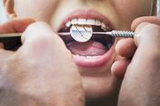 Apakah Tambal Gigi Berlubang Ditanggung BPJS Kesehatan? Ini Penjelasannya