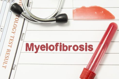 Myelofibrosis