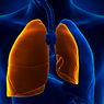 Pneumotoraks: Gejala dan Penyebab