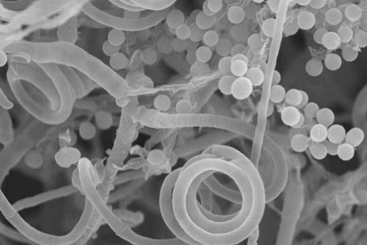 Organisme yang menyebabkan jamur kurap (spesies Trichophyton rubrum) terlihat jauh lebih cantik di bawah mikroskop daripada di kaki Anda.
