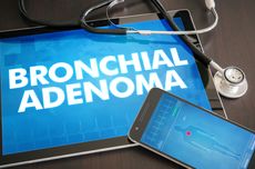Adenoma Bronkial