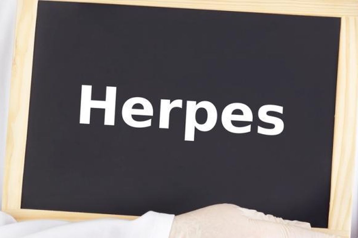 Ilustrasi penyakit herpes