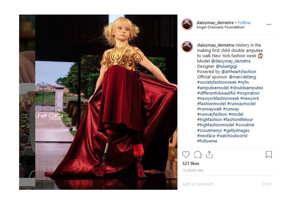 Daisy-May Demetre, yang baru berusia sembilan tahun, menjadi model cilik pertama dengan amputasi ganda yang secara resmi melenggak-lenggok di catwalk perhelatan akbar NYFW.