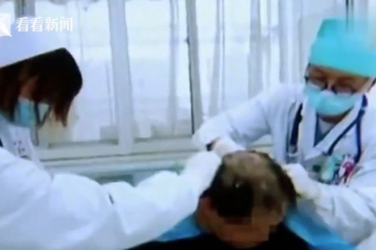 Dokter di Kunming, China, harus menggunduli rambut seorang pria setelah tak sengaja keramas menggunakan pestisida.